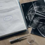 ACR4 pourcentage cancer : repérer ACR4a ACR4b ACR4c sur compte-rendu médical avec imagerie mammaire