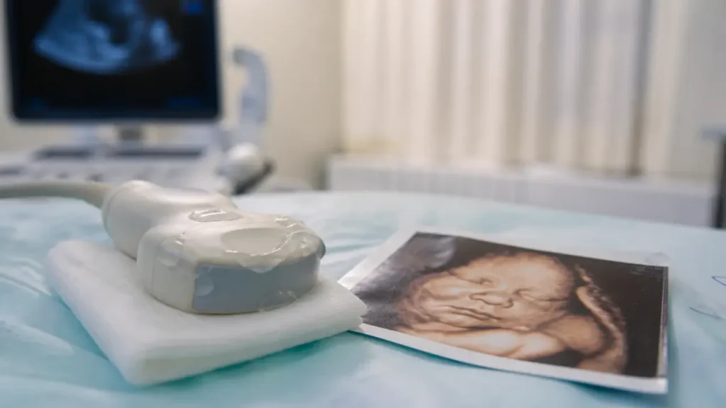 Échographie 3D bébé : entre 24 et 28 SA, la fenêtre la plus favorable, avec prix et limites