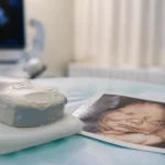 Echographie 3d bebe entre 24 et 28 SA : prix et limites