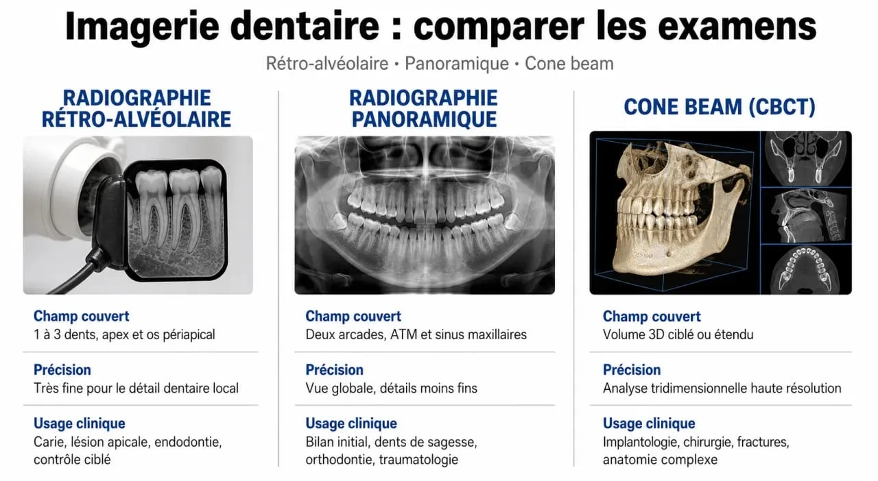 Comparatif rétro alvéolaire, panoramique et cone beam pour comprendre le choix de l’examen dentaire