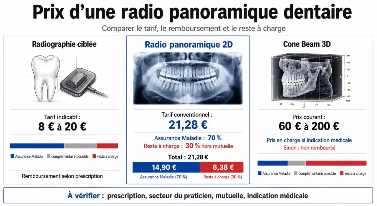 Radio panoramique dentaire prix : comparaison entre 2D, radiographie ciblée et Cone Beam 3D avec remboursement et reste à charge