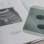 Ganglions infracentimétriques : masses <10 mm, souvent physiologiques