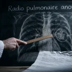 Radio poumon anormale : opacité, nodule ou pneumothorax sur radiographie thoracique