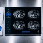 Scanner Paris 15 : CT 128 barrettes, prise en charge spécialisée